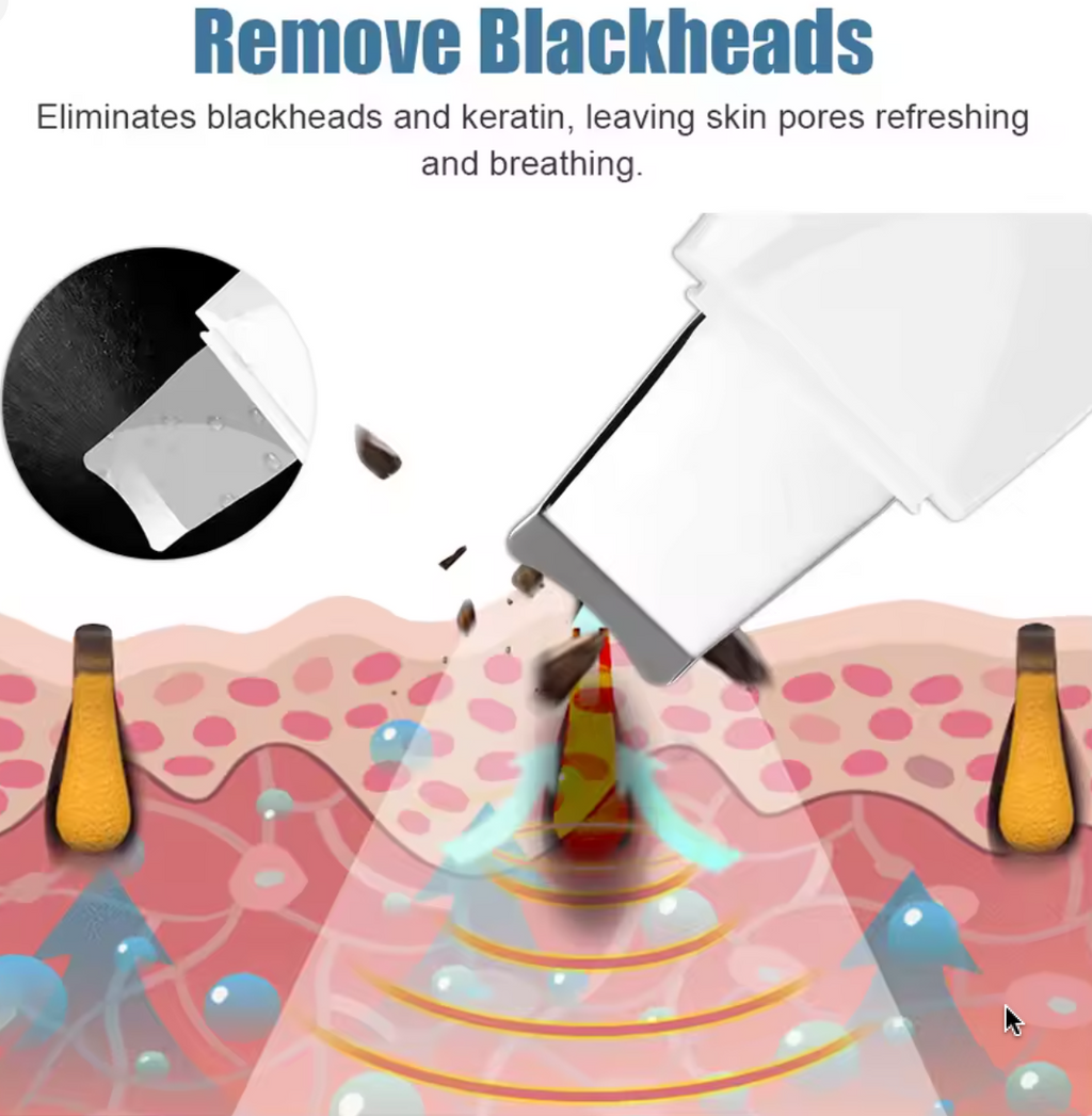 جهاز تنظيف البشرة بالموجات فوق الصوتية - أداة لإزالة الرؤوس السوداء من الوجه