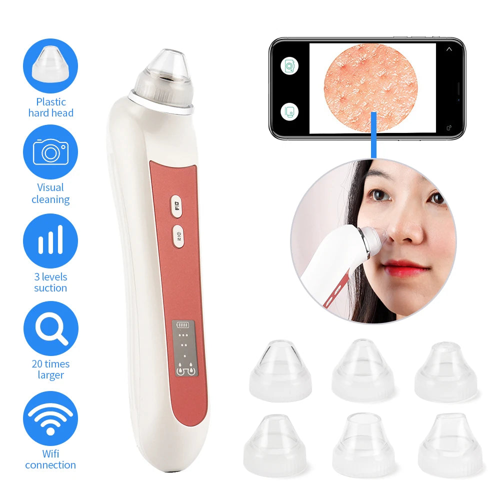Blackhead Remover with Camera – HD Pore Cleaner Tool