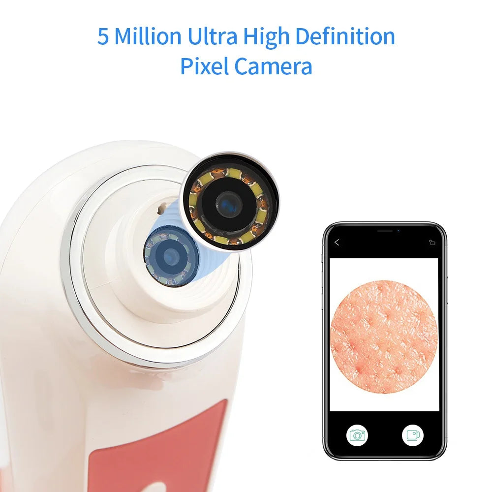 Blackhead Remover with Camera – HD Pore Cleaner Tool