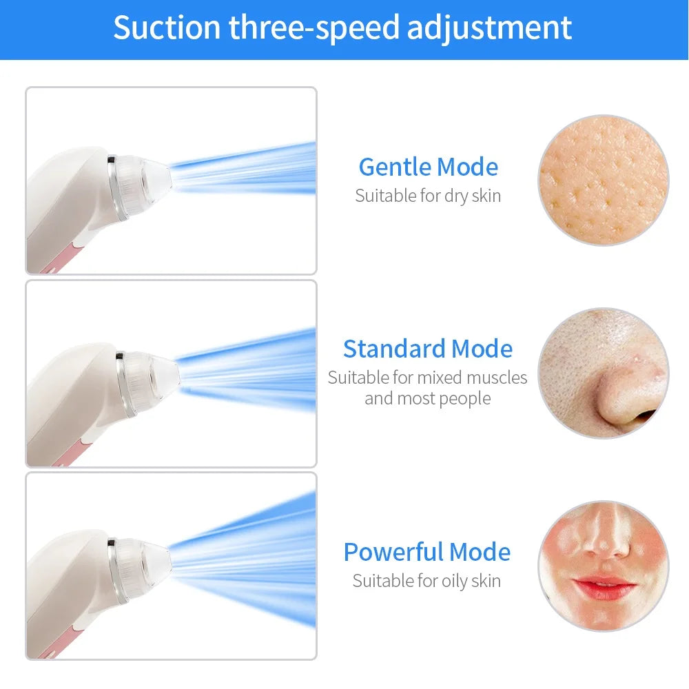 Blackhead Remover with Camera – HD Pore Cleaner Tool