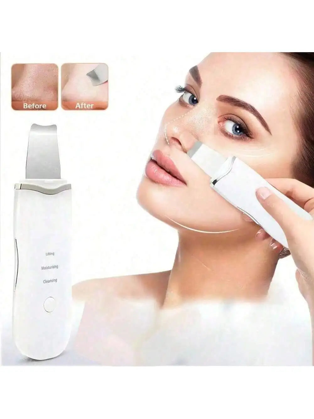 Ultrasonic Skin Scrubber – Blackhead Remover Facial Tool